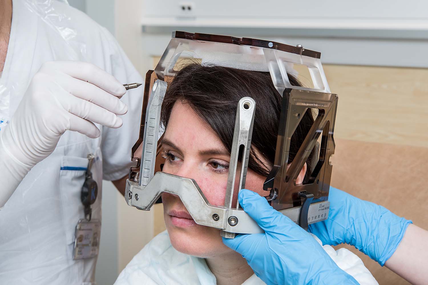 Närbild på patient med en stereotaktisk ram på huvudet inför strålknivsbehandling