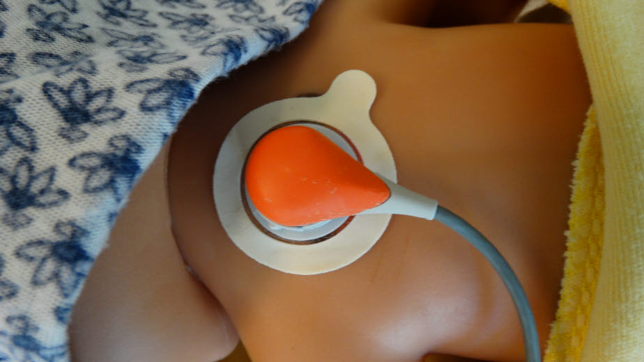 Transcutaneous measurement of blood gas pressure