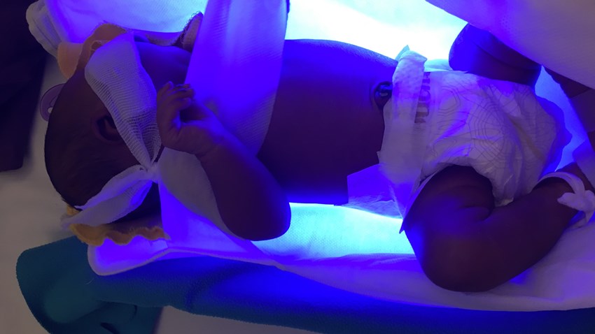 phototherapy