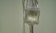 dialysis