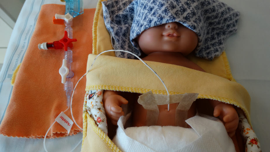 Umbilical artery catheter