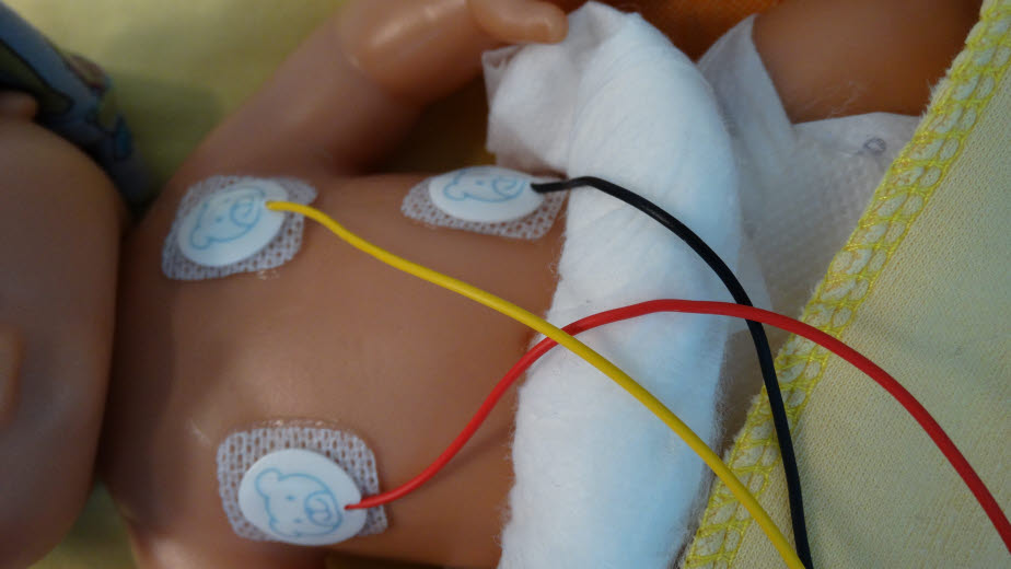 ECG Monitoring