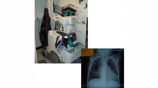 X-ray examination