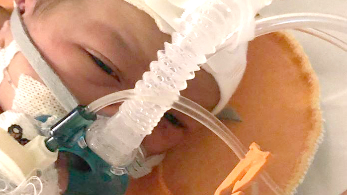 nasal prong and mask