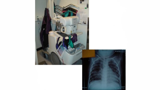 x-ray
