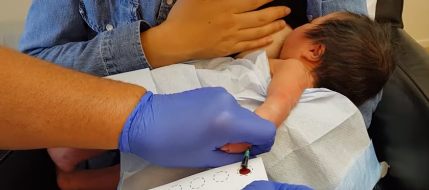 Ett blodprov, så kallat PKU-prov tas av en läkare på en ammande bebis hand. 