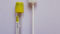 Borsyrerör + Adapter, gulgrön propp