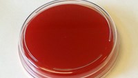 Agar tryckplatta