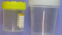 Provtagningsburk för sputum mm