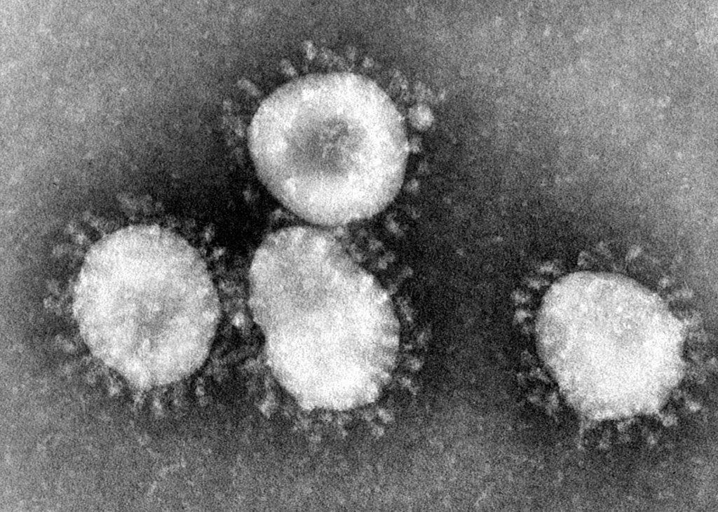 bild på coronavirus tagen med elektornmikroskop